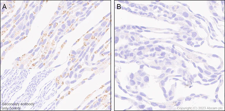 Immunohistochemistry (Formalin/PFA-fixed paraffin-embedded sections) - Anti-SQSTM1 / p62 antibody [RM1079] - Autophagosome Marker (AB314504)