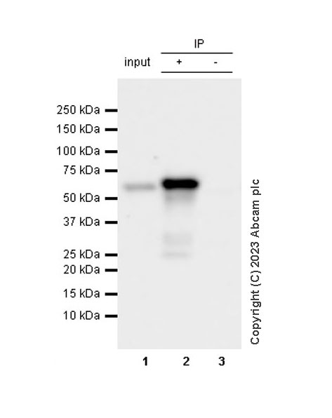 Immunoprecipitation - Anti-SQSTM1 / p62 antibody [RM1079] - Autophagosome Marker (AB314504), expandable thumbnail