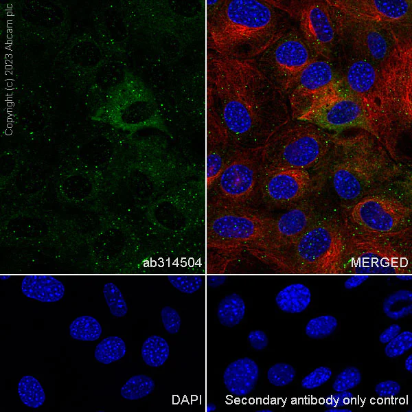 Immunocytochemistry/ Immunofluorescence - Anti-SQSTM1 / p62 antibody [RM1079] - BSA and Azide free (AB314505)
