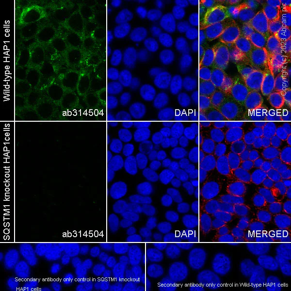 Immunocytochemistry/ Immunofluorescence - Anti-SQSTM1 / p62 antibody [RM1079] - BSA and Azide free (AB314505)