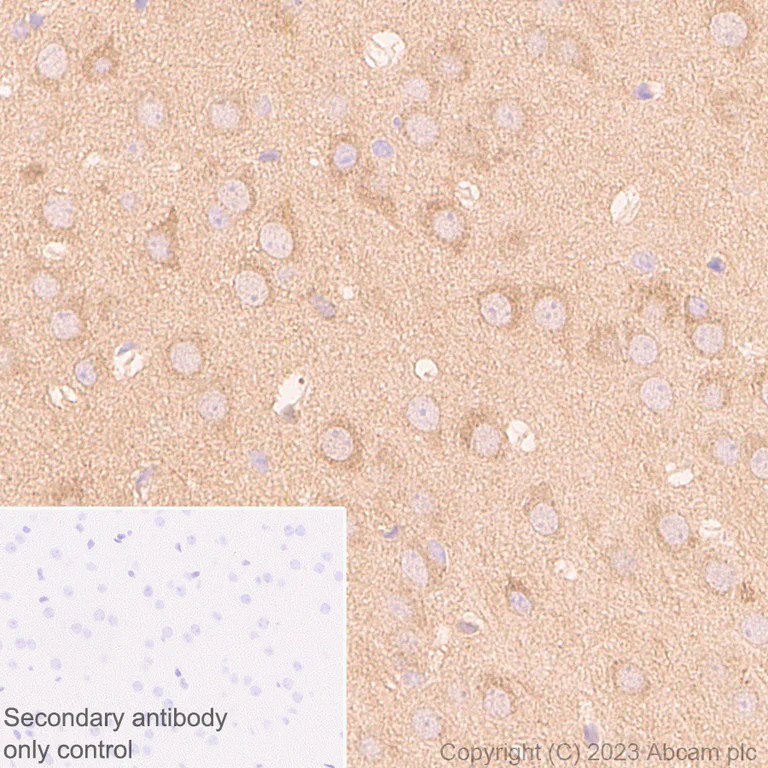 Immunohistochemistry (Formalin/PFA-fixed paraffin-embedded sections) - Anti-SQSTM1 / p62 antibody [RM1079] - BSA and Azide free (AB314505)