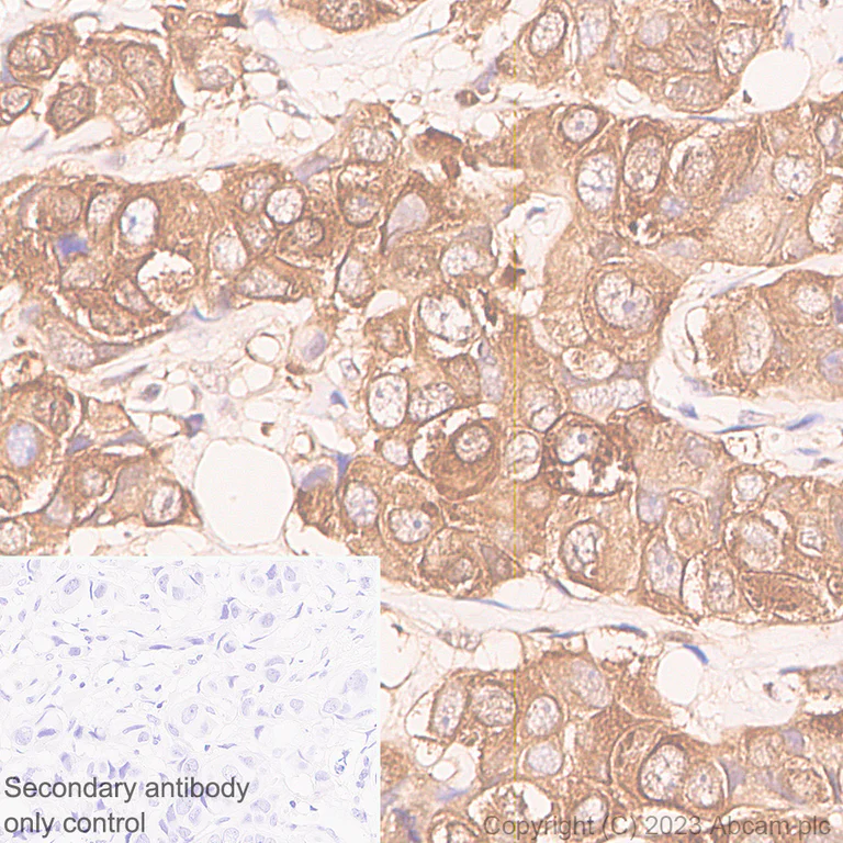 Immunohistochemistry (Formalin/PFA-fixed paraffin-embedded sections) - Anti-SQSTM1 / p62 antibody [RM1079] - BSA and Azide free (AB314505)