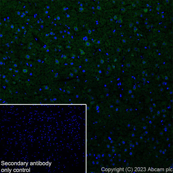 Immunohistochemistry (Frozen sections) - Anti-SQSTM1 / p62 antibody [RM1079] - BSA and Azide free (AB314505)