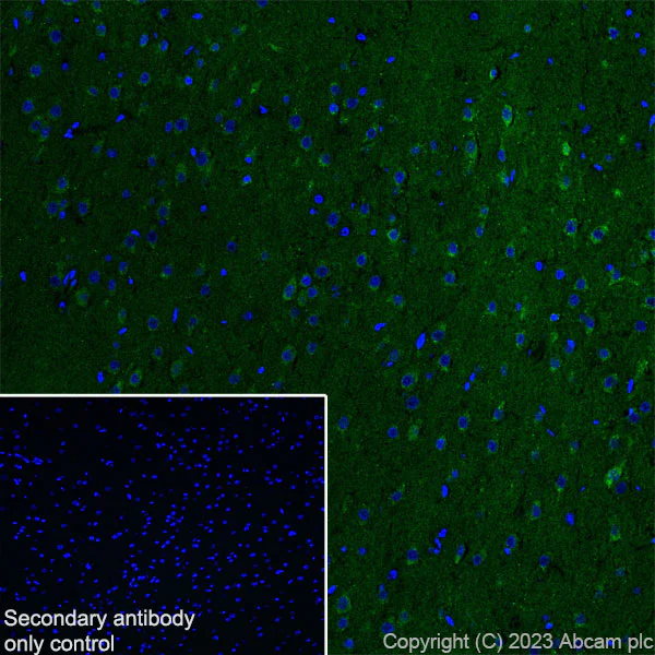 Immunohistochemistry (Frozen sections) - Anti-SQSTM1 / p62 antibody [RM1079] - BSA and Azide free (AB314505)