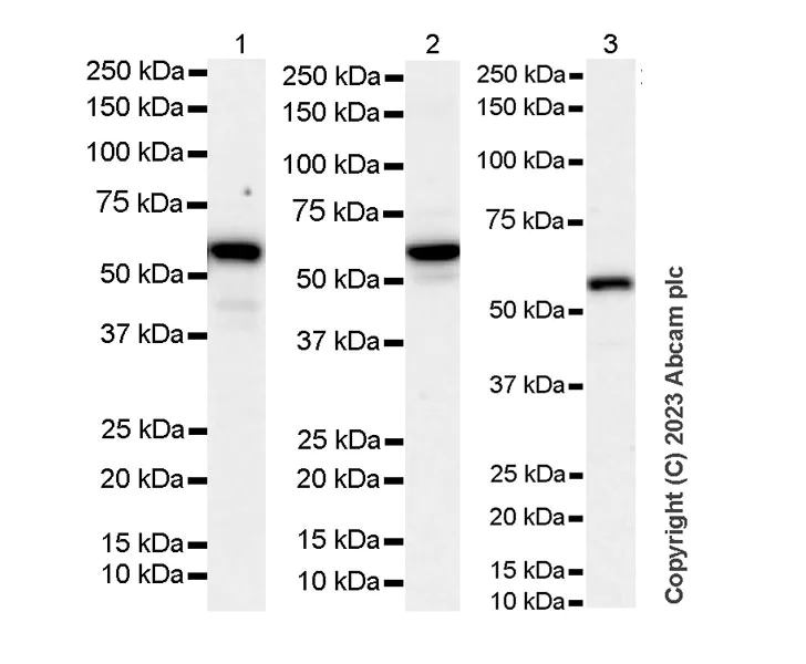 Western blot - Anti-SQSTM1 / p62 antibody [RM1079] - BSA and Azide free (AB314505)