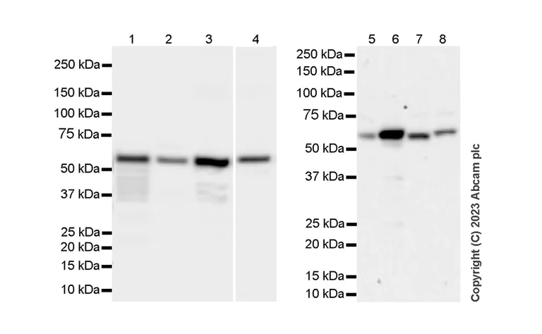 Western blot - Anti-SQSTM1 / p62 antibody [RM1079] - BSA and Azide free (AB314505)