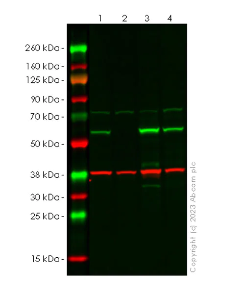 Western blot - Anti-SQSTM1 / p62 antibody [RM1079] - BSA and Azide free (AB314505)