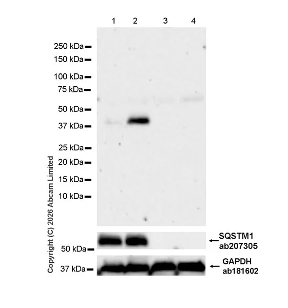 Western blot - Anti-SQSTM1 / p62 at D329 (N-terminal) antibody [EPR29289-46] (AB325681)