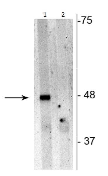 Western blot - Anti-SQSTM1 / p62 (phospho S28) antibody (AB254038), expandable thumbnail