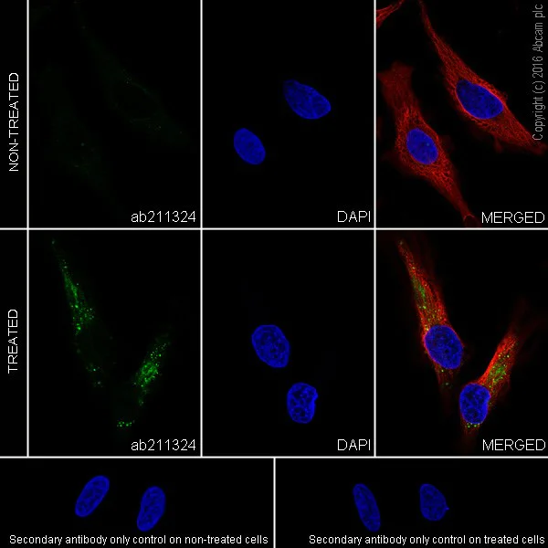 Immunocytochemistry/ Immunofluorescence - Anti-SQSTM1 / p62 (phospho S349) antibody [EPR20451] (AB211324)