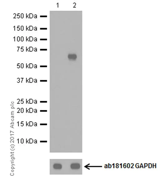 Western blot - Anti-SQSTM1 / p62 (phospho S349) antibody [EPR20451] (AB211324)