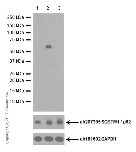 Western blot - Anti-SQSTM1 / p62 (phospho S349) antibody [EPR20451] (AB211324)