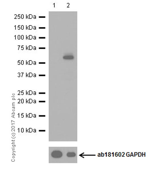 Western blot - Anti-SQSTM1 / p62 (phospho S349) antibody [EPR20451] (AB211324)