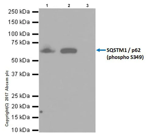 Immunoprecipitation - Anti-SQSTM1 / p62 (phospho S349) antibody [EPR20451] - BSA and Azide free (AB238445)