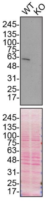 Anti-SQSTM1 / p62 (phospho S349) antibody [EPR20451] - BSA and Azide free
