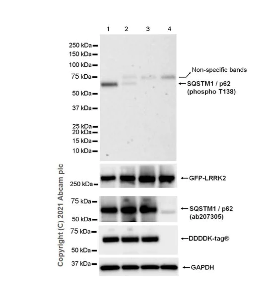 Western blot - Anti-SQSTM1 / p62 (phospho T138) antibody [MJF-R44-20] - BSA and Azide free (AB285172)