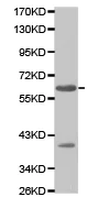 Western blot - Anti-Squalene Epoxidase antibody (AB189773)