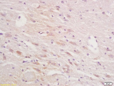 Immunohistochemistry (Formalin/PFA-fixed paraffin-embedded sections) - Anti-Squalene Epoxidase antibody (AB203300)