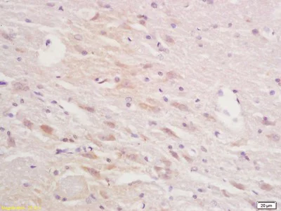 Immunohistochemistry (Formalin/PFA-fixed paraffin-embedded sections) - Anti-Squalene Epoxidase antibody (AB203300)