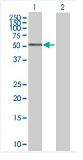 Western blot - Anti-Squalene Epoxidase antibody (AB67479)