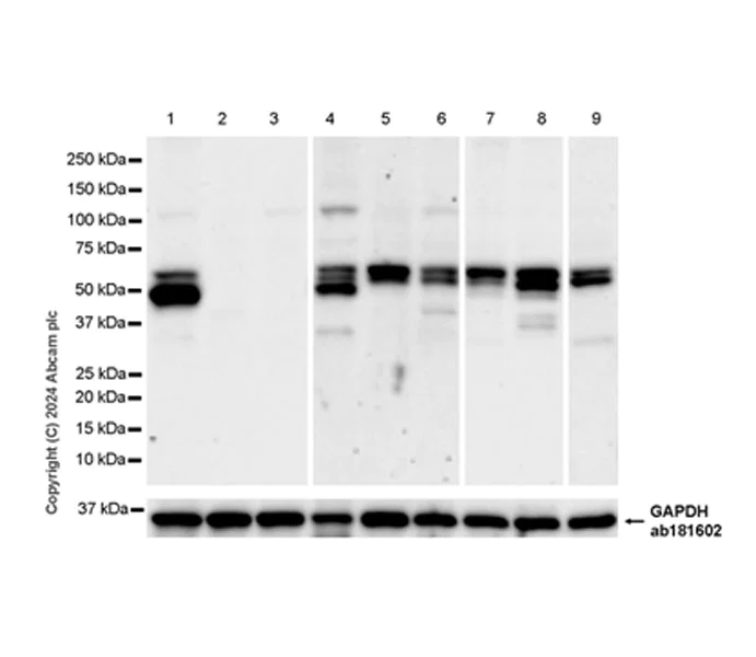 Western blot - Anti-Squalene Epoxidase antibody [EPR29195-89] (AB317628)