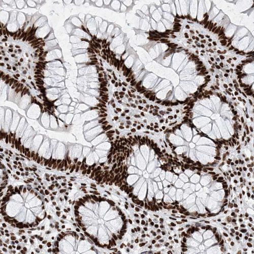Immunohistochemistry (Formalin/PFA-fixed paraffin-embedded sections) - Anti-SR protein repeat/SRSF6 antibody (AB244425), expandable thumbnail