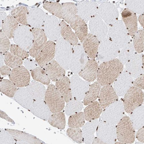 Immunohistochemistry (Formalin/PFA-fixed paraffin-embedded sections) - Anti-SR protein repeat/SRSF6 antibody (AB244425), expandable thumbnail