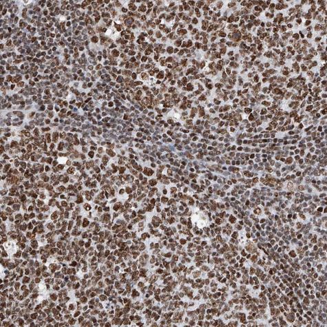 Immunohistochemistry (Formalin/PFA-fixed paraffin-embedded sections) - Anti-SR protein repeat/SRSF6 antibody (ab244425), expandable thumbnail