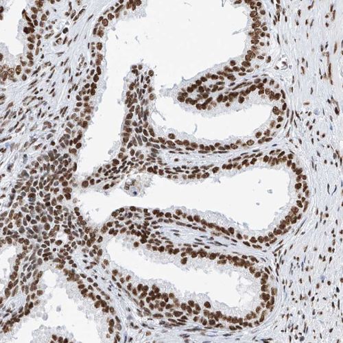 Immunohistochemistry (Formalin/PFA-fixed paraffin-embedded sections) - Anti-SR protein repeat/SRSF6 antibody (AB244425), expandable thumbnail
