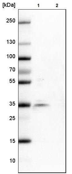 Western blot - Anti-SR protein repeat/SRSF6 antibody (AB244425), expandable thumbnail