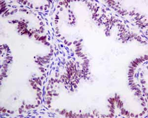 Immunohistochemistry (Formalin/PFA-fixed paraffin-embedded sections) - Anti-SR protein repeat/SRSF6 antibody [EPR9231] (AB140623)