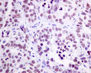 Immunohistochemistry (Formalin/PFA-fixed paraffin-embedded sections) - Anti-SR protein repeat/SRSF6 antibody [EPR9231] (AB140623)