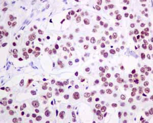 Immunohistochemistry (Formalin/PFA-fixed paraffin-embedded sections) - Anti-SR protein repeat/SRSF6 antibody [EPR9231] (AB140623)