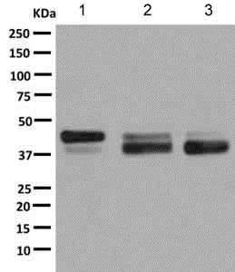 Western blot - Anti-SR protein repeat/SRSF6 antibody [EPR9231] (AB140623)
