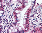 Immunohistochemistry (Formalin/PFA-fixed paraffin-embedded sections) - Anti-SR1 antibody (AB71983), expandable thumbnail