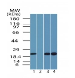 Western blot - Anti-SR1 antibody (AB71983), expandable thumbnail