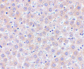 Immunohistochemistry (Formalin/PFA-fixed paraffin-embedded sections) - Anti-sRANKL antibody (AB62516)