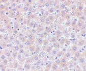 Immunohistochemistry (Formalin/PFA-fixed paraffin-embedded sections) - Anti-sRANKL antibody (AB62516)
