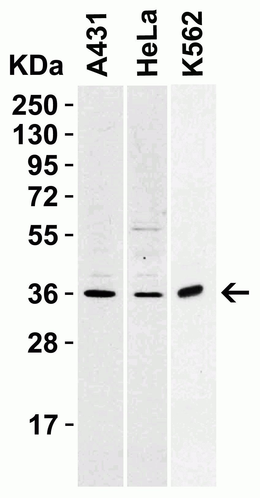 Western blot - Anti-sRANKL antibody (AB62516)