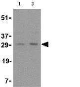 Western blot - Anti-sRANKL antibody (AB62516)