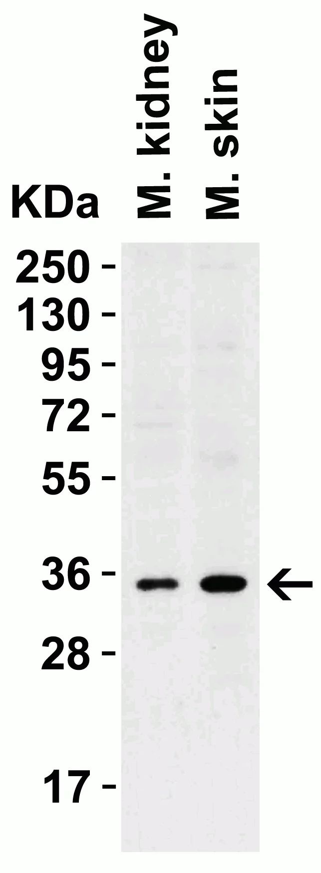Western blot - Anti-sRANKL antibody (AB62516)