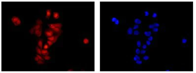 Immunocytochemistry/ Immunofluorescence - Anti-SRAP antibody [EPR11776] (AB183725)