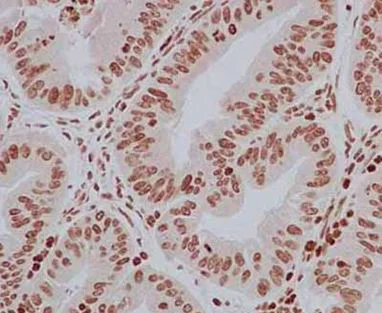 Immunohistochemistry (Formalin/PFA-fixed paraffin-embedded sections) - Anti-SRAP antibody [EPR11776] (AB183725)