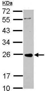 Western blot - Anti-SRBC antibody (AB151322)