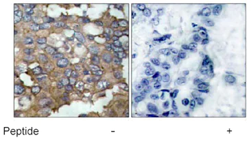 Immunohistochemistry (Formalin/PFA-fixed paraffin-embedded sections) - Anti-Src antibody (AB47405)