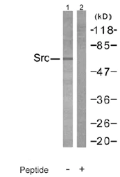Western blot - Anti-Src antibody (AB47405)