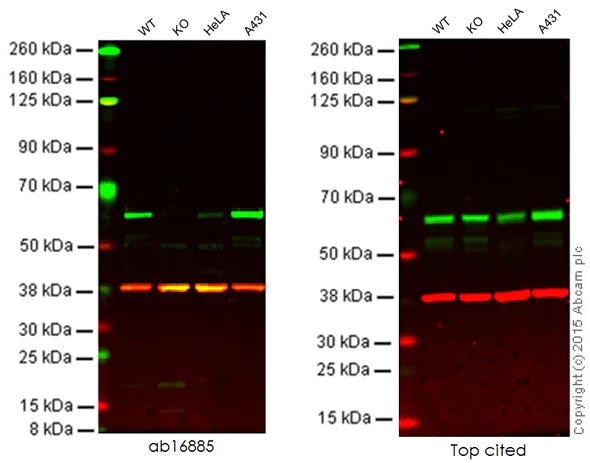 Western blot - Anti-Src antibody [Clone 327] (AB16885)