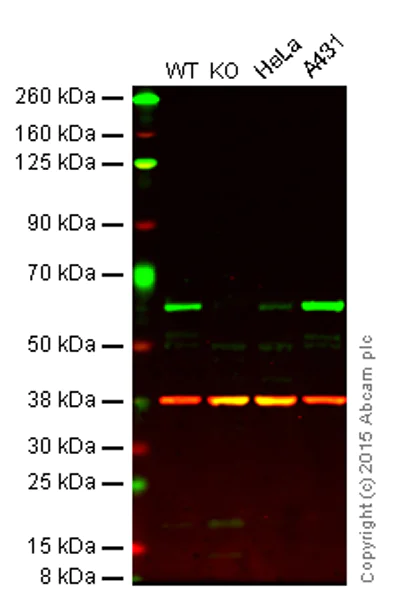 Western blot - Anti-Src antibody [Clone 327] (AB16885)