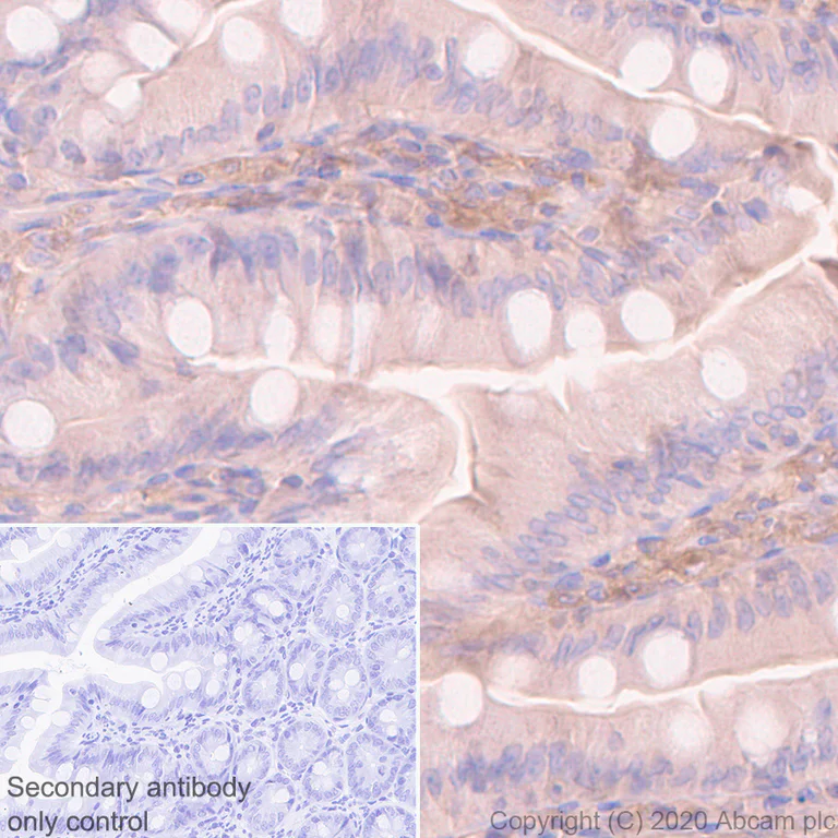 Immunohistochemistry (Formalin/PFA-fixed paraffin-embedded sections) - Anti-Src antibody [EGTR103] - BSA and Azide free (AB222221)