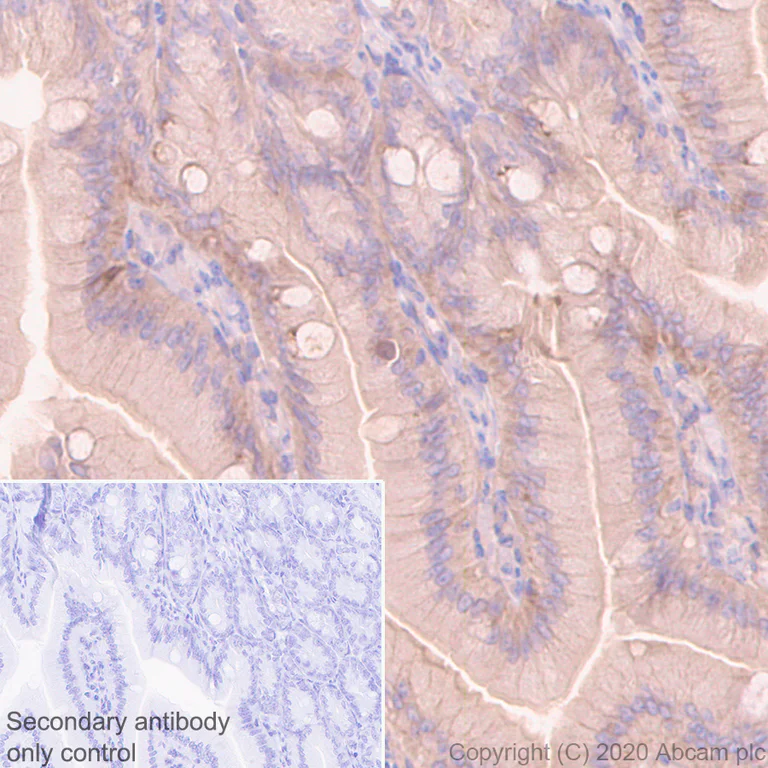 Immunohistochemistry (Formalin/PFA-fixed paraffin-embedded sections) - Anti-Src antibody [EGTR103] - BSA and Azide free (AB222221)